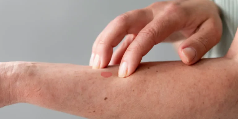 5 Önemli Belirtiyle Lyme Hastalığı Rehberi