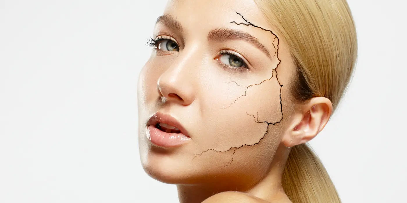 Cilt Kuruluğuna Son Vermek İçin 6 Uzman Önerisi